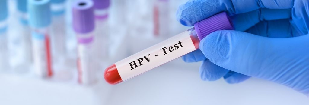 HPV Antigen Test Kit