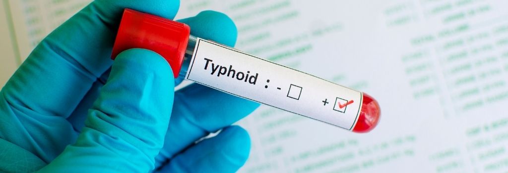 Typhoid Test Kit